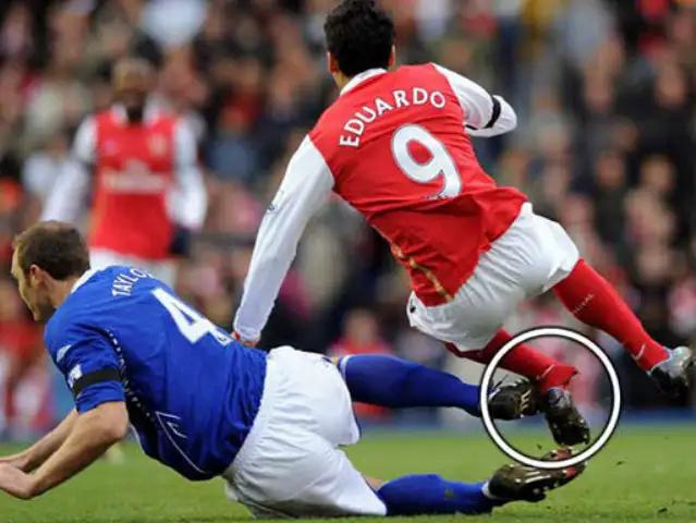 od体育直播-包含足球赛事中球员受伤事件牵动球迷心.的词条